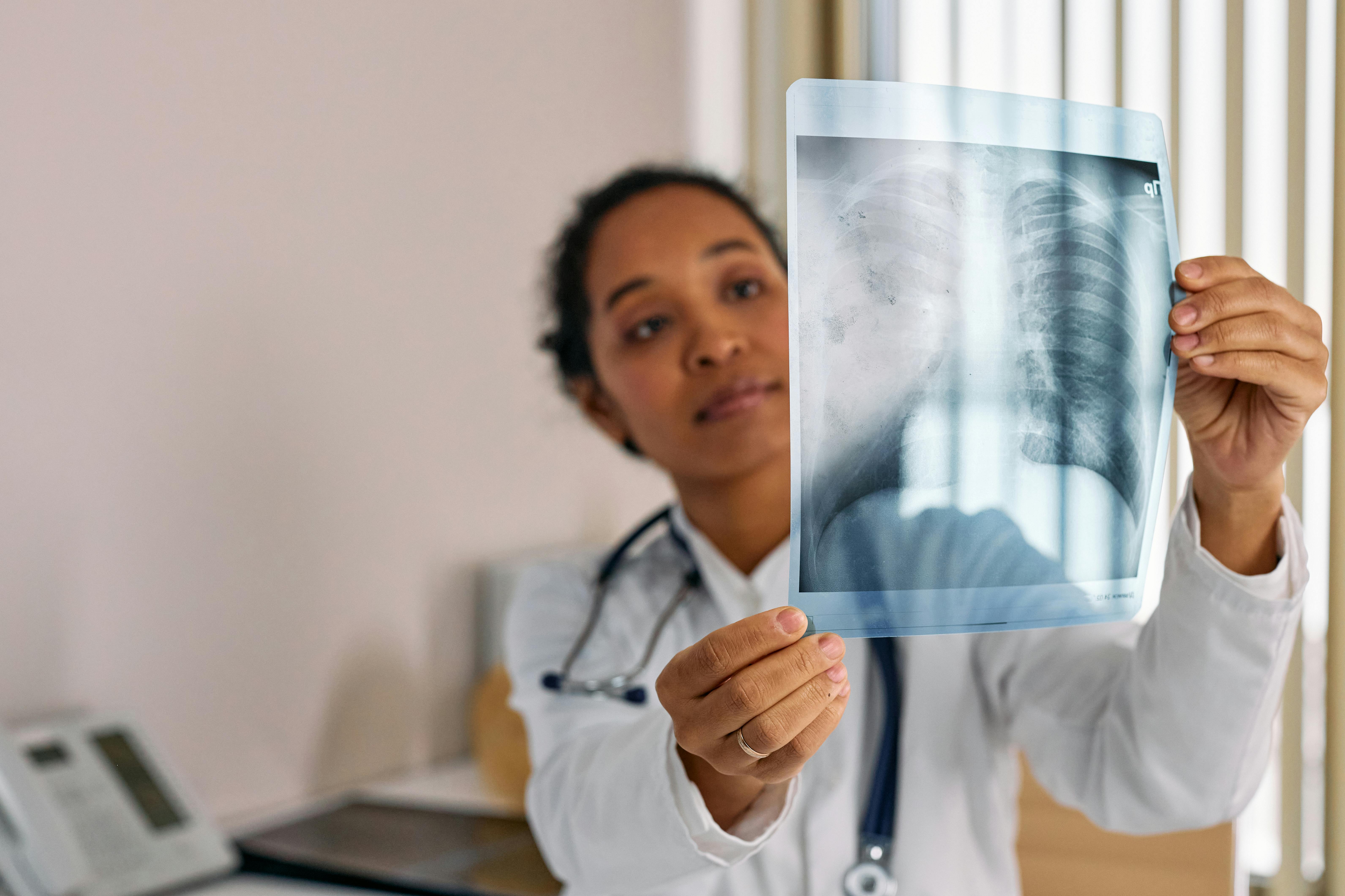 Doctor showing an x-ray of lungs